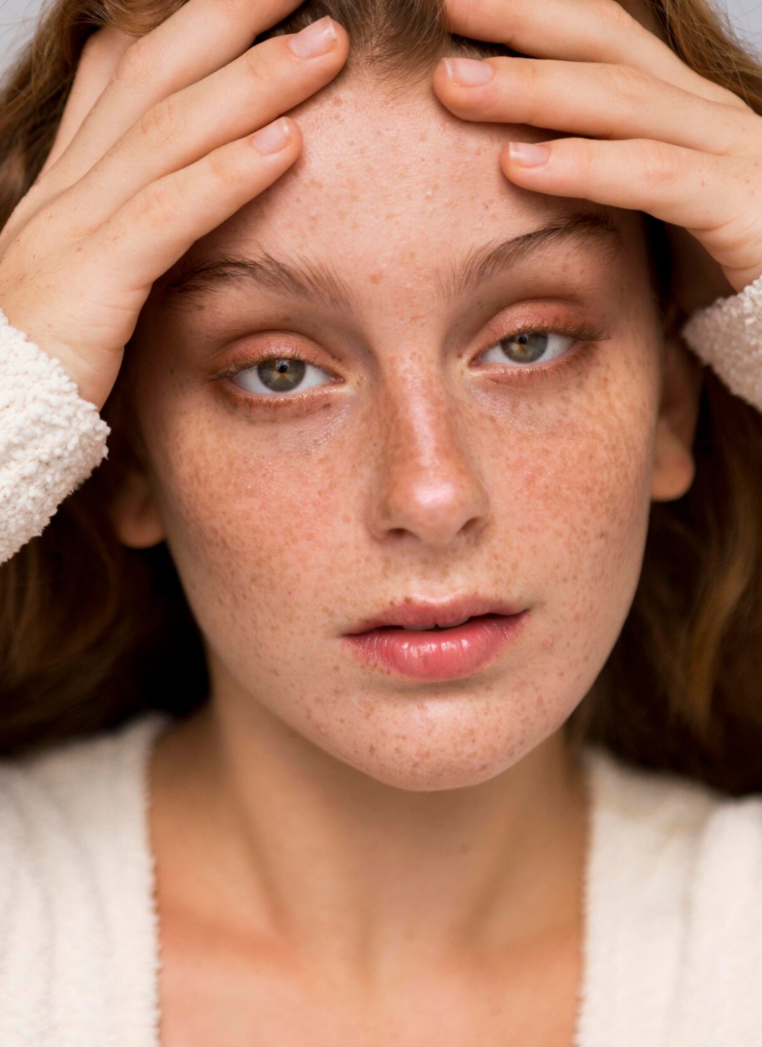 Jerawat di Pelipis? Ini 5 Penyebab Utamanya