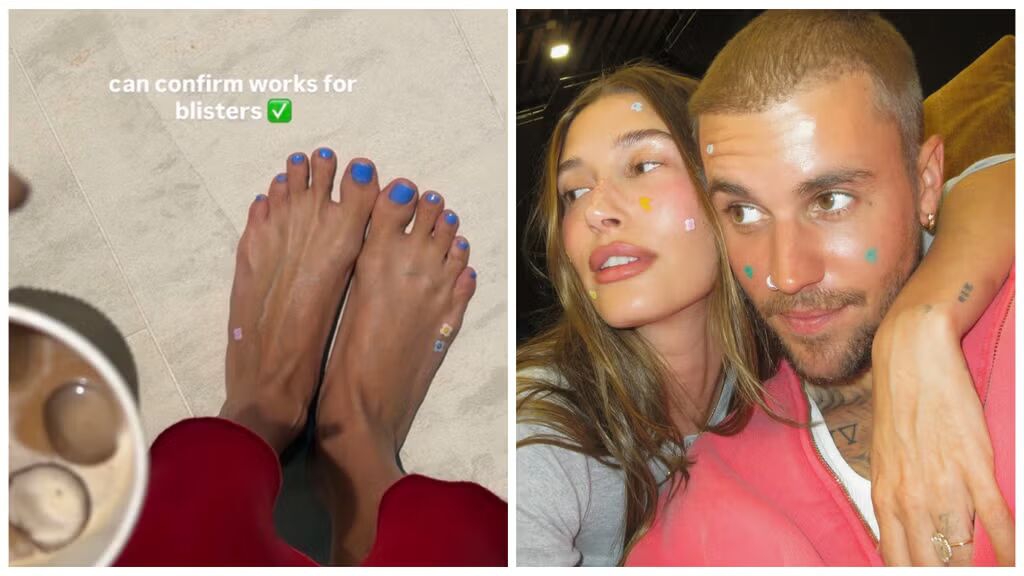 Mengapa Hailey Bieber Mengenakan Patch Jerawat di Kakinya?
