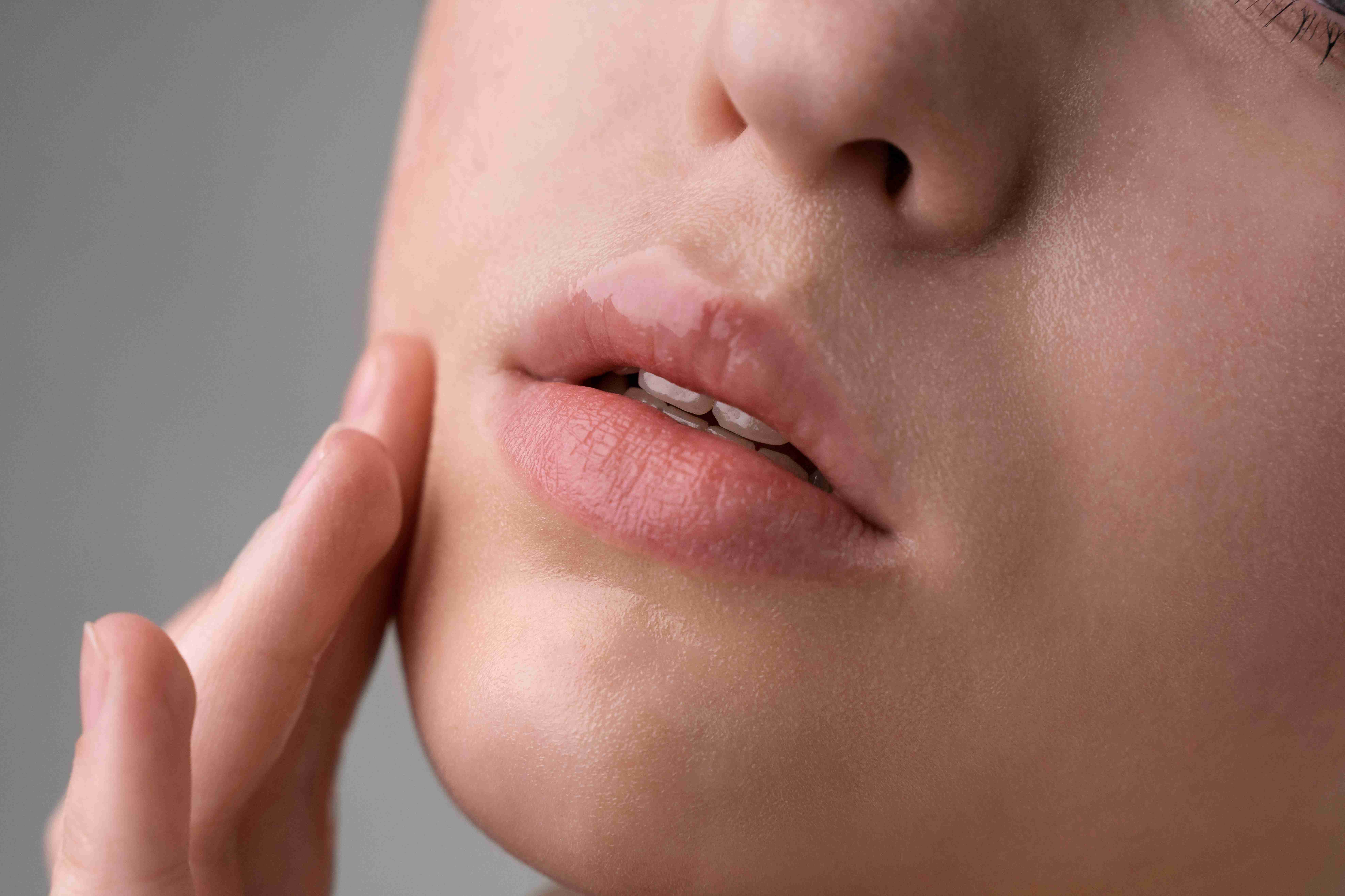 Cara Melembabkan Bibir Secara Alami yang Bisa Anda Coba di Rumah