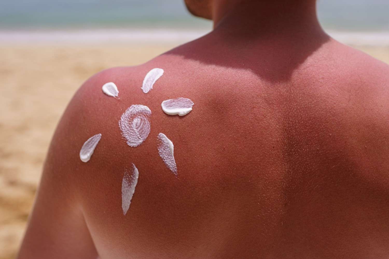 Kenali Perbedaan Chemical dan Physical Sunscreen Sebelum Anda Pakai