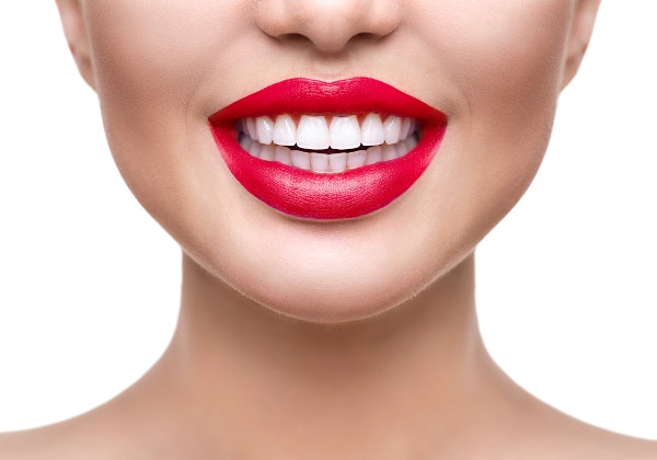 Serba-Serbi Veneer Gigi