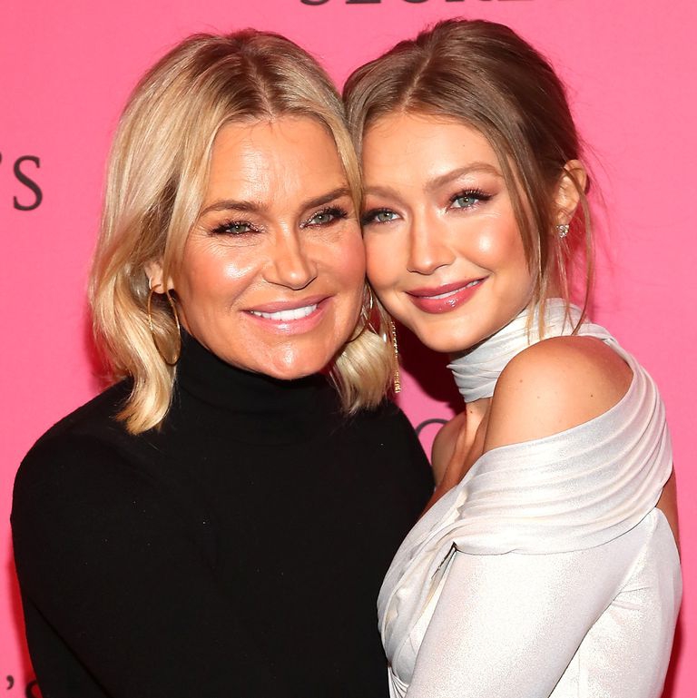 Yolanda Hadid Menghilangkan Botulinum Toxin dan Fillernya
