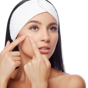 Cara Jitu Menghilangkan Jerawat Batu