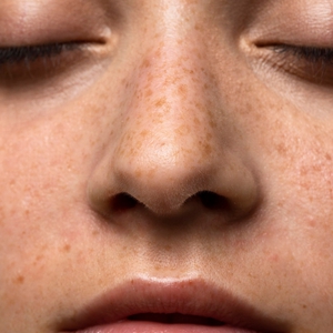 Cara Jitu Membantu Mengelupas Flek Hitam dengan Cepat dan Aman