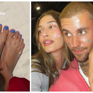 Mengapa Hailey Bieber Mengenakan Patch Jerawat di Kakinya?