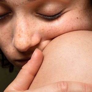 Kenali Hiperpigmentasi Kulit dan Solusi Ampuh untuk Mengatasinya