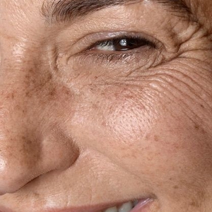 10 Penyebab Flek Hitam di Wajah yang Sering Diabaikan, Waspadai Sebelum Terlambat