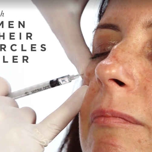 Semua yang Perlu Anda Ketahui Tentang Filler Kantung Mata
