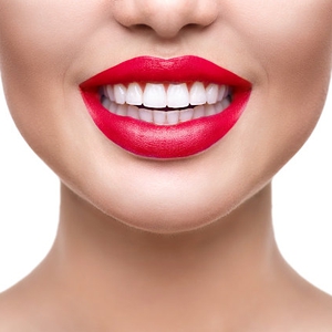 Serba-Serbi Veneer Gigi