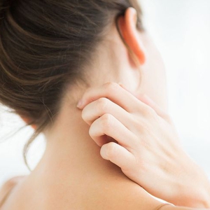 #SkinSchool: Apa itu Eczema?    