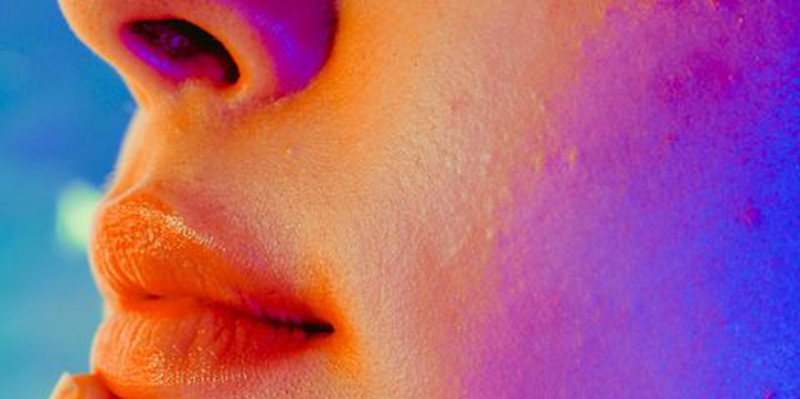 Obat Kurangi Jerawat Hormonal Kini Resmi Beredar di Amerika