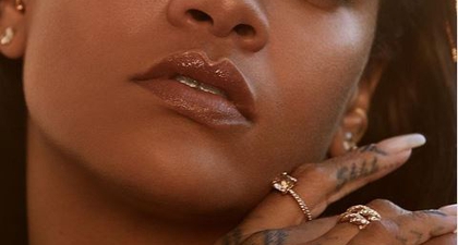 Wajah Rihanna Terluka Ketika Terjatuh Dari Skuter