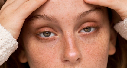 Jerawat di Pelipis? Ini 5 Penyebab Utamanya