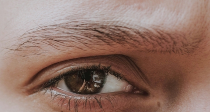 Cara Mengatasi Mata Bengkak Secara Instan