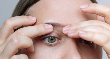 Kenali Penyebab Milia di Wajah dan Cara Mengatasinya