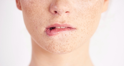 Jangan Abaikan Bintik Putih di Bibir, Simak Cara Menghilangkannya Secara Alami