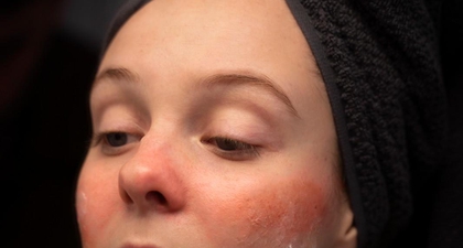 Rekomendasi Sunscreen Untuk Kulit Sensitif dan Berjerawat