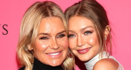 Yolanda Hadid Menghilangkan Botulinum Toxin dan Fillernya